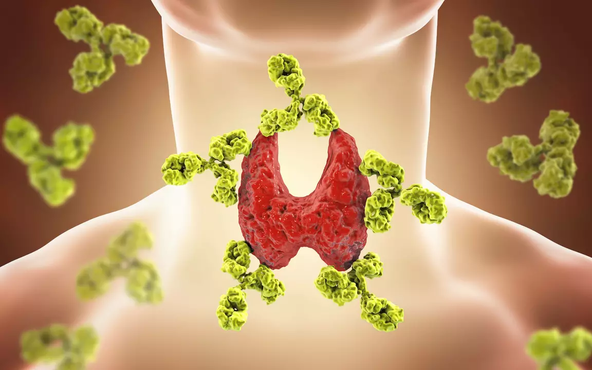 The Connection Between Hashimoto's Disease and Thyroid Cancer