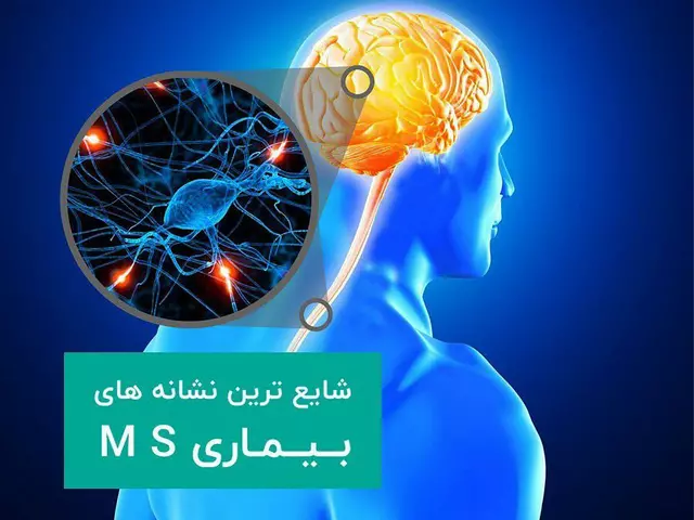 The connection between muscle spasms and multiple sclerosis